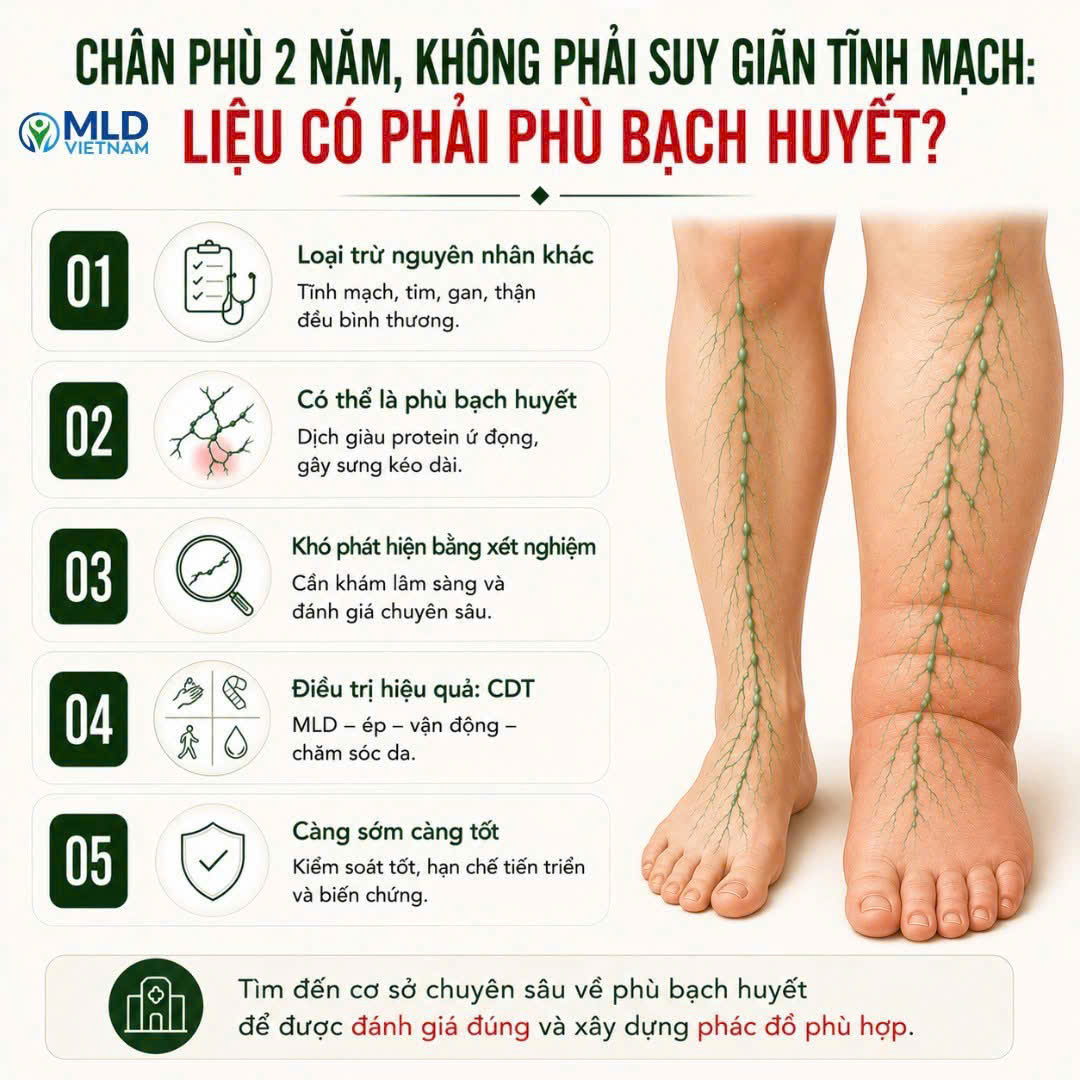 Chân phù 2 năm, không phải suy giãn tĩnh mạch: liệu có phải phù bạch huyết ?