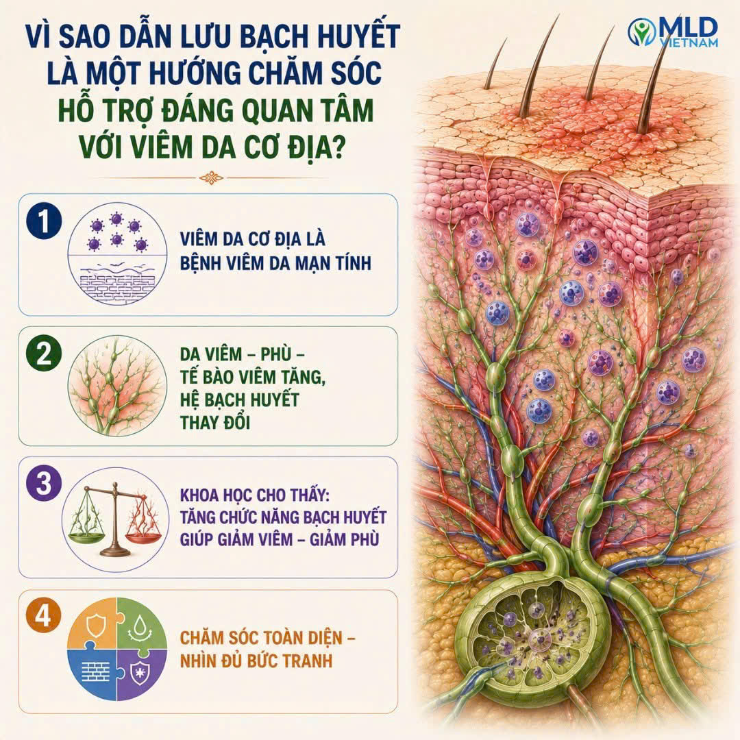 Vì sao dẫn lưu bạch huyết là một hướng chăm sóc hỗ trợ đáng quan tâm với Viêm da cơ địa?