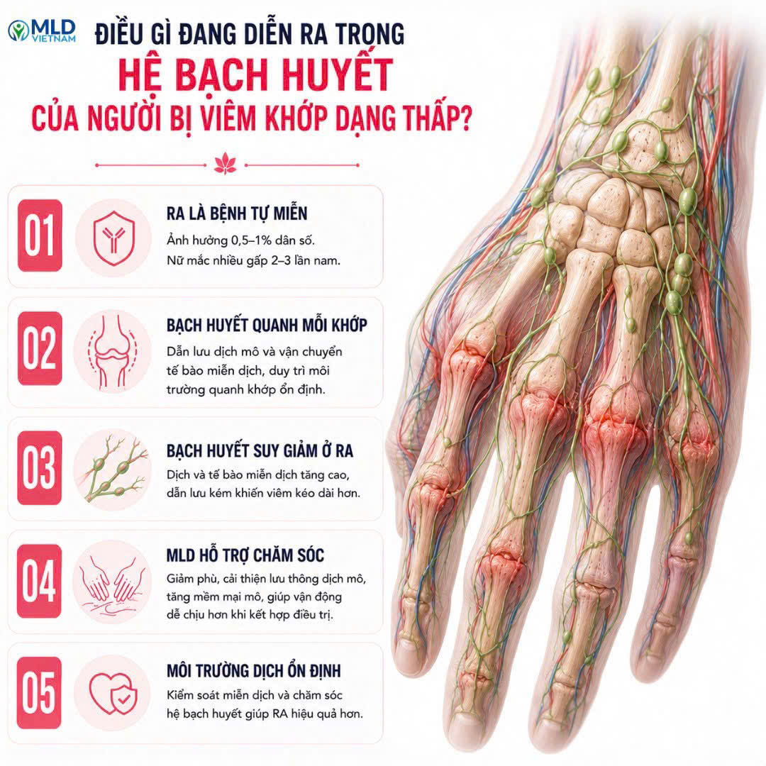 Điều gì đang diễn ra trong hệ bạch huyết của người bị viêm khớp dạng thấp?